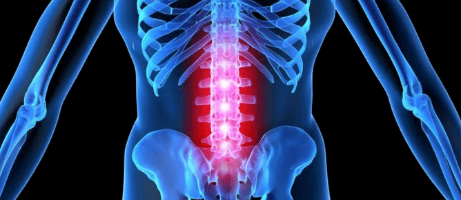 Deformation of the disc