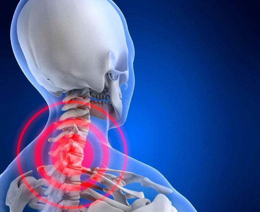Neck pain with cervical joint disease