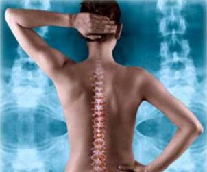 Illustration of the lumbar spine