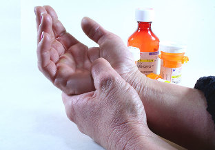 treatments for arthritis and dry joints