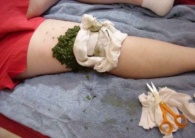 compression for knee arthritis