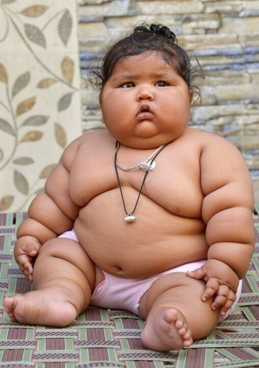 Being overweight causes arthritis