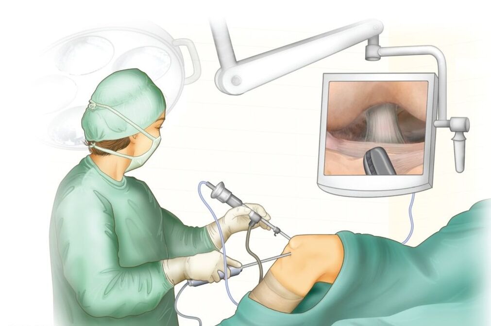 Knee surgery