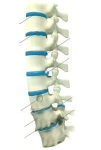 manifestation of bone necrosis of the lumbar spine