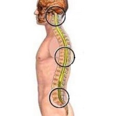 nature of lumbar spine necrosis
