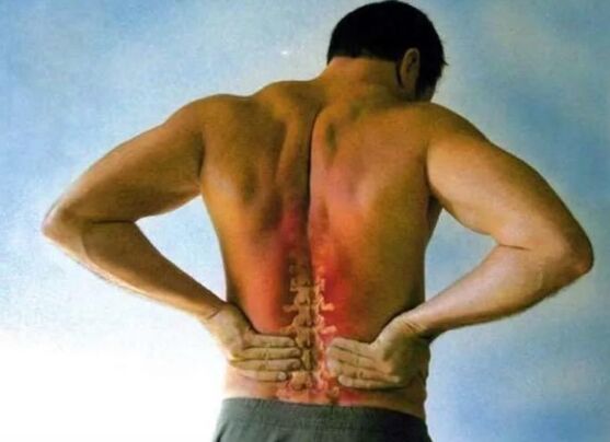 Pain for lumbar osteoarthritis